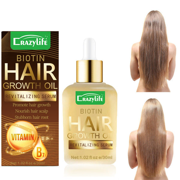 Hair Hair Care Essential Oil 30ml Soft And Refreshing Hanzuva