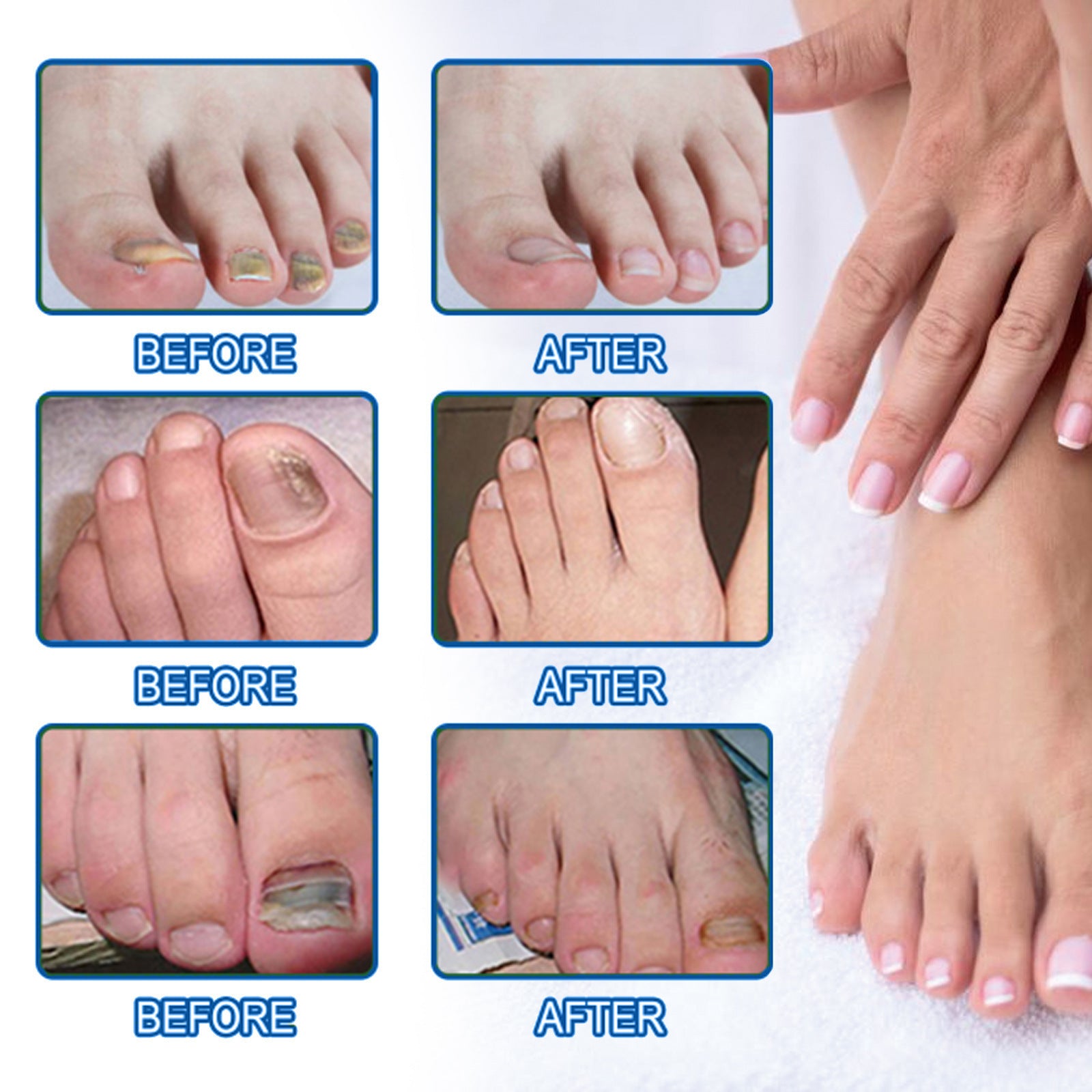 Nail Nursing Adhesive Bandage Repair