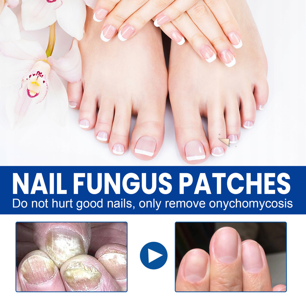 Nail Nursing Adhesive Bandage Repair