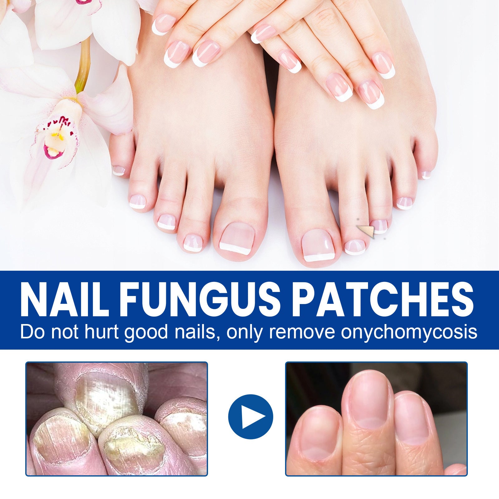 Nail Nursing Adhesive Bandage Repair