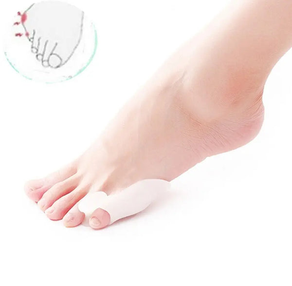 1 pair of silicone small toe finger straight hair toe valgus toe deformity device Hanzuva