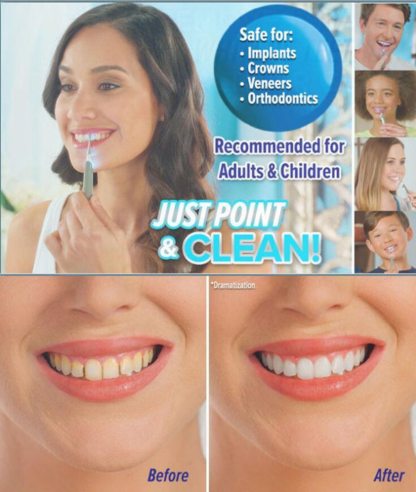 Dental Cleaner Teeth whitening Hanzuva