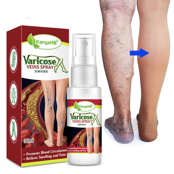Vein Spray Earthworm Leg Vascular Fluid Hanzuva
