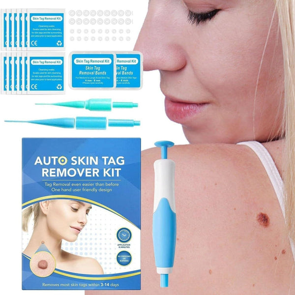 Skin-removing Pen Meat-removing Mole-removing Wart-removing Device 2-generation Boxed Hanzuva