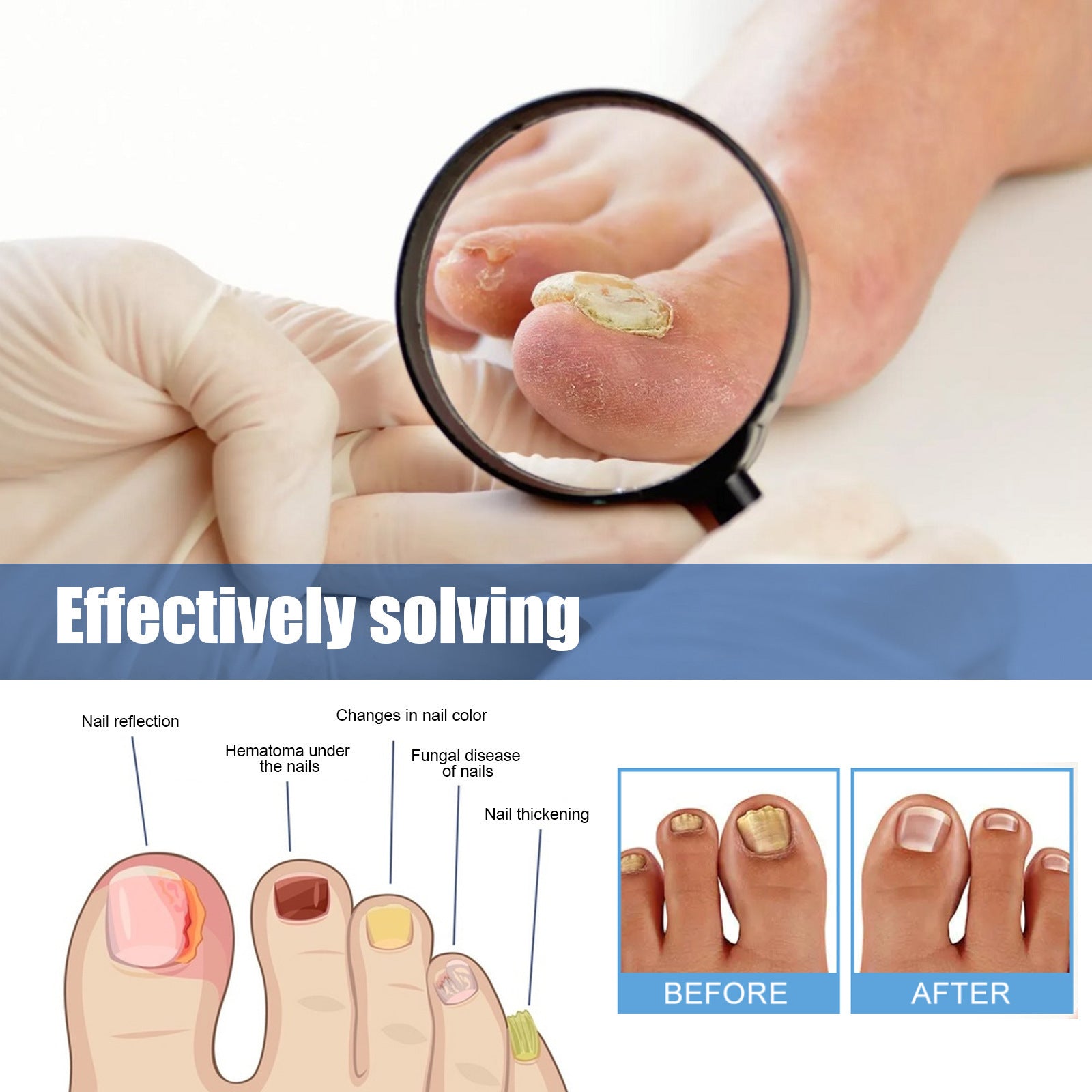 Nail Nursing Adhesive Bandage Repair