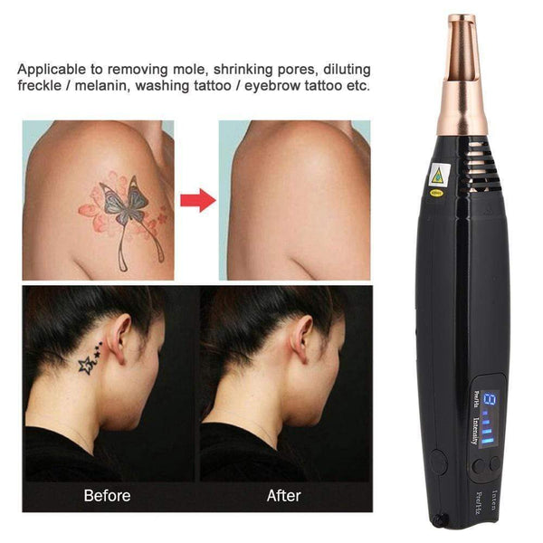 Red And Blue Facial Beauty And Spot-sweeping Pen Home Beauty Instrument Hanzuva