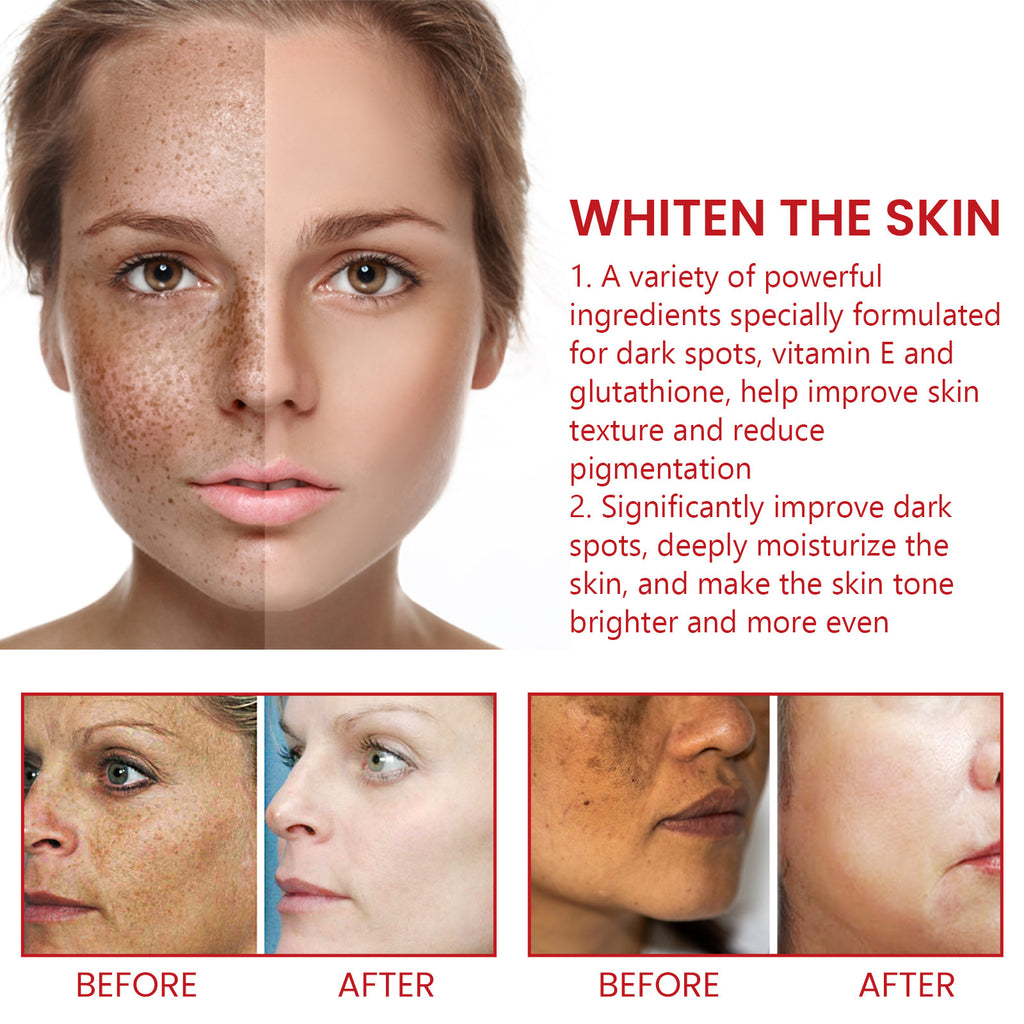Black Spot Repair Cream Fading Wrinkle
