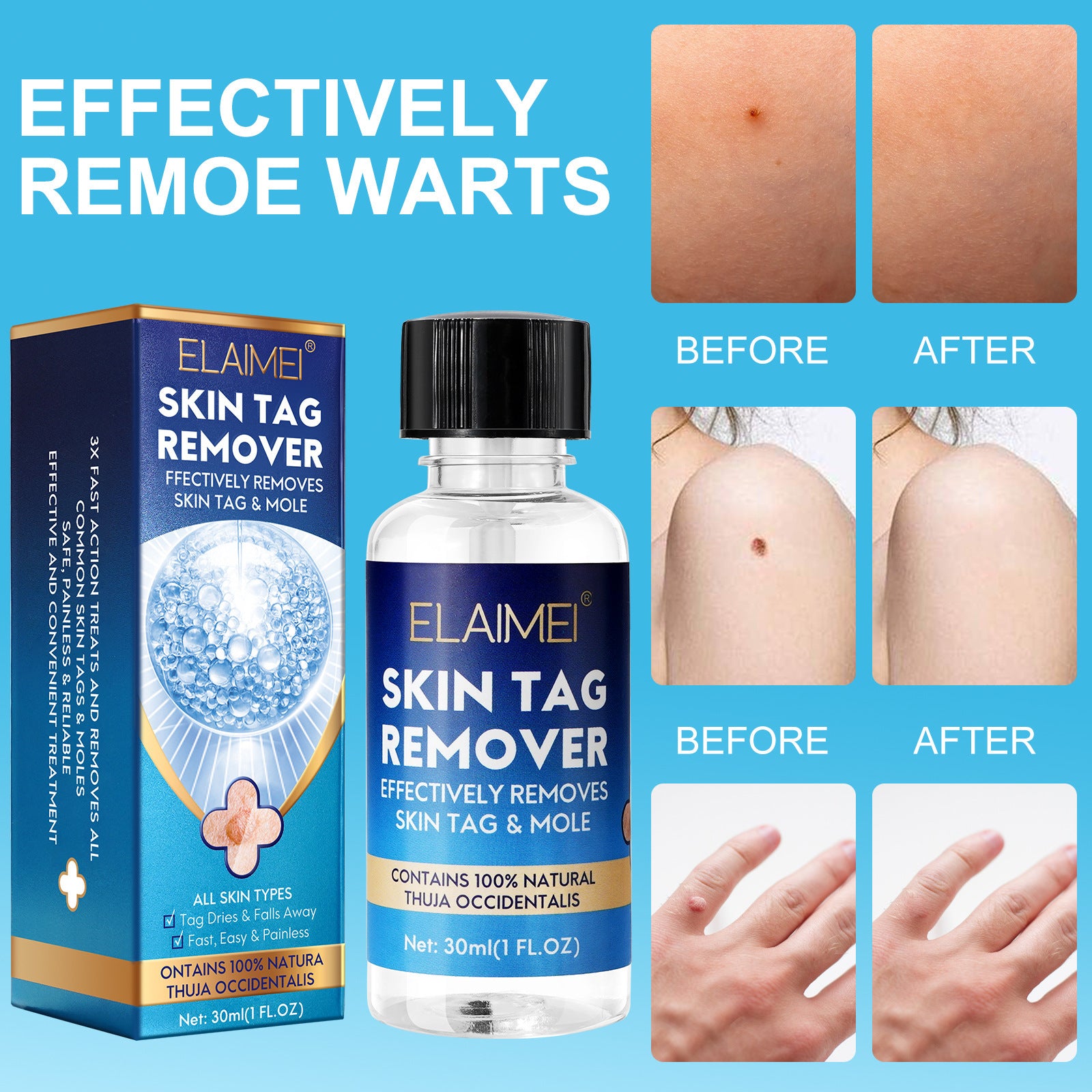 Deyou Solution Bottled Portable