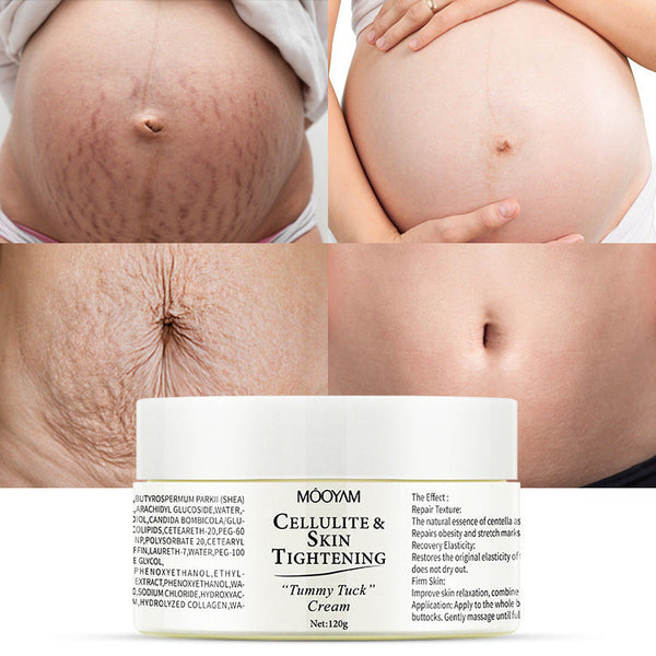 Stretch Mark Cream Fat Body Pattern Recovery Cream Hanzuva