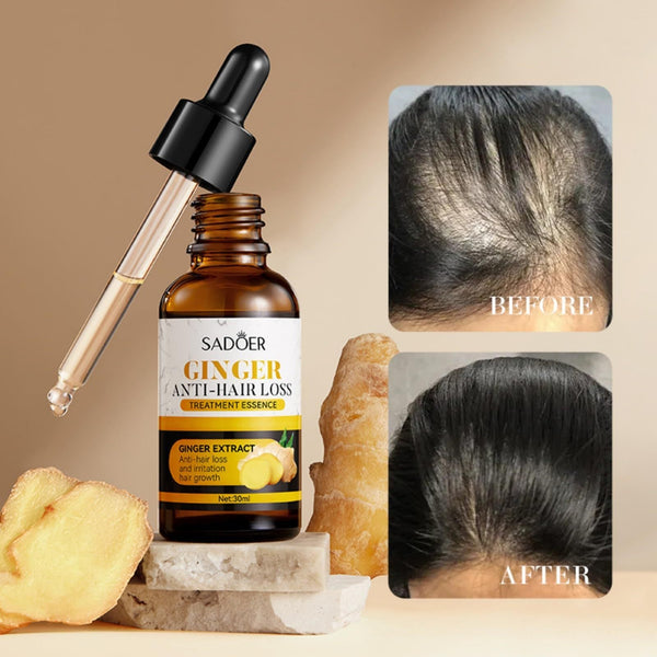 Ginger Care Oil Hair Loss Growth Hanzuva